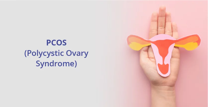 PCOS: The Mysterious Party-Crasher of Womanhood and How